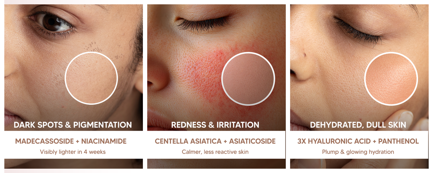 Pure Centella Brightening Serum with Niacinamide, Madecassoside & 3X Hyaluronic Acid