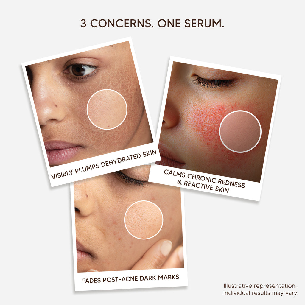 Pure Centella Brightening Serum with Niacinamide, Madecassoside & 3X Hyaluronic Acid