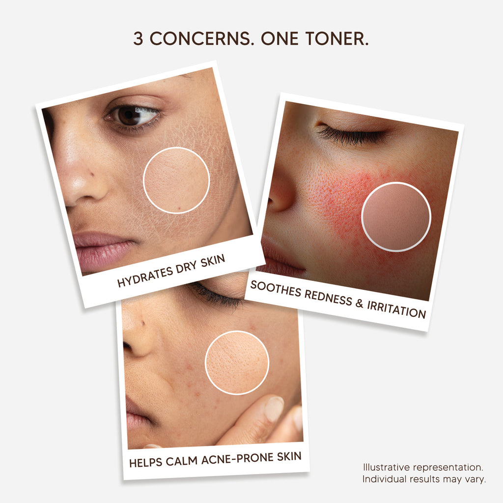Pure Centella Tranquil Toner with Niacinamide, Glucono-Delta-Lactone & Hyaluronic Acid