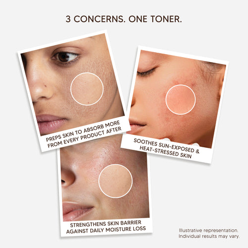 Advanced Snail Mucin Hydrating Toner with Aloe Vera, Allantoin & Panthenol